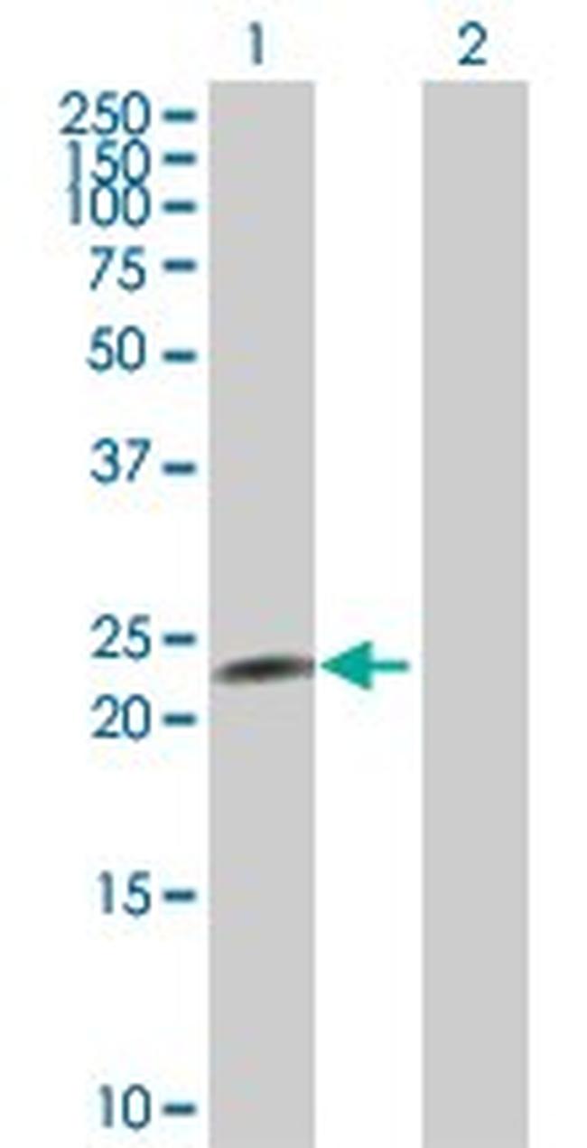 CNTF Antibody in Western Blot (WB)