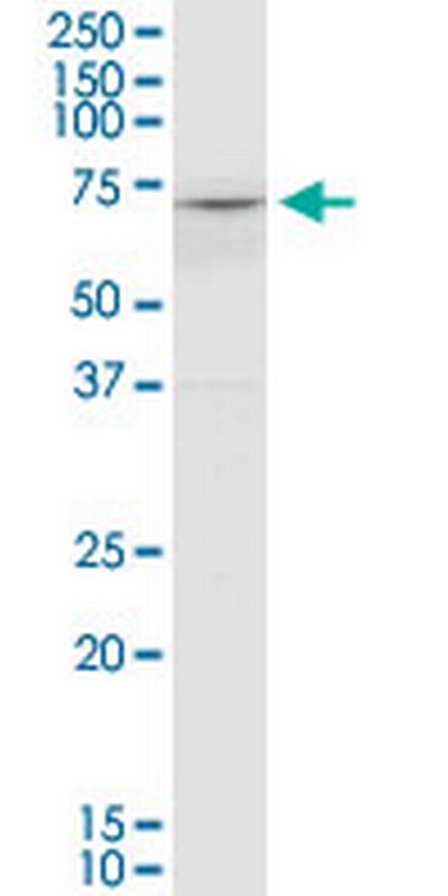 COL8A2 Antibody in Western Blot (WB)