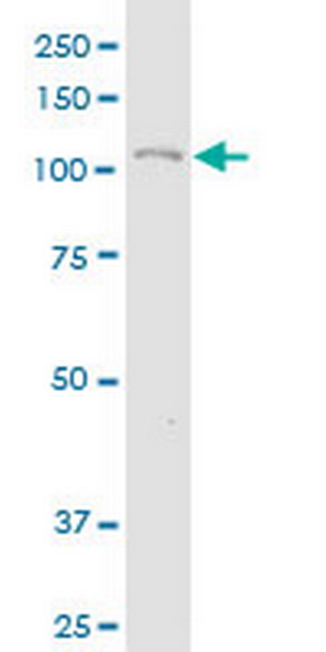 COL19A1 Antibody in Western Blot (WB)