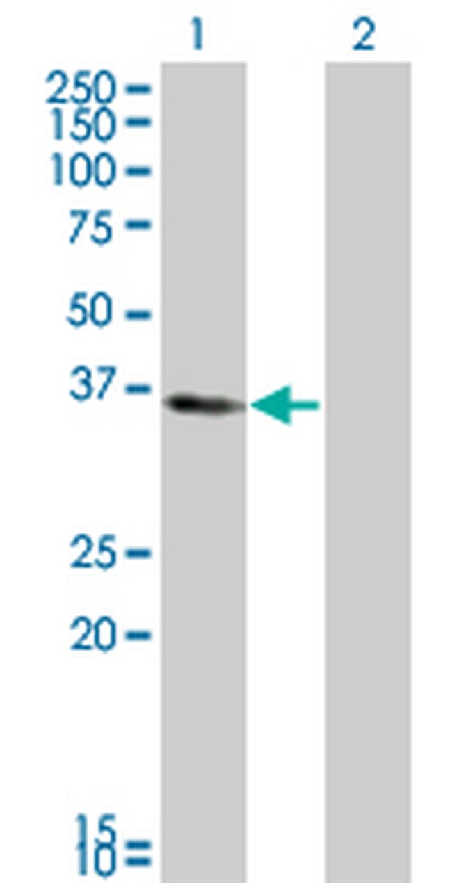 KLF6 Antibody in Western Blot (WB)