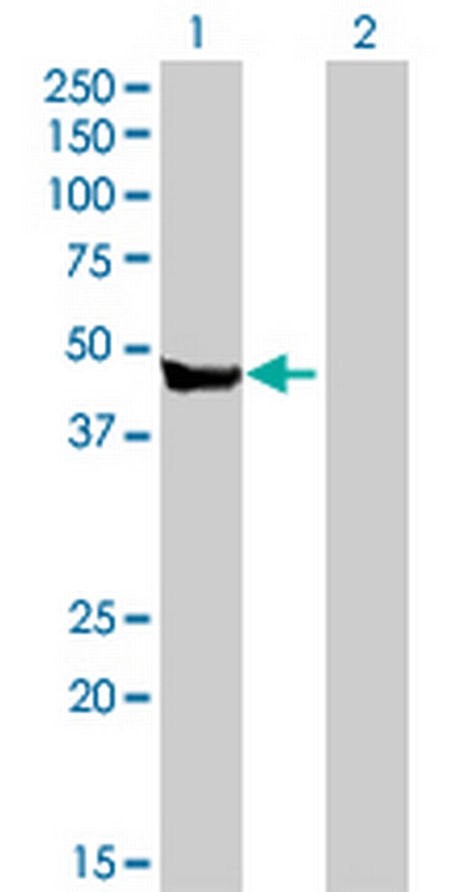 CPA2 Antibody in Western Blot (WB)