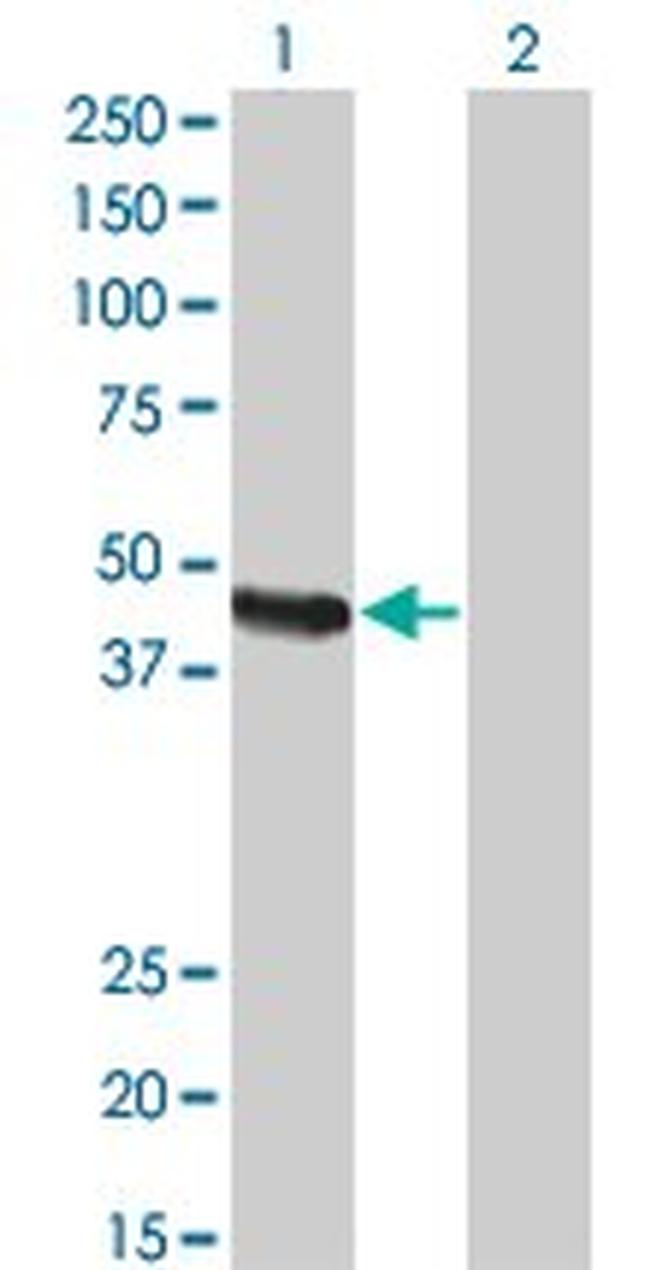 CPA2 Antibody in Western Blot (WB)