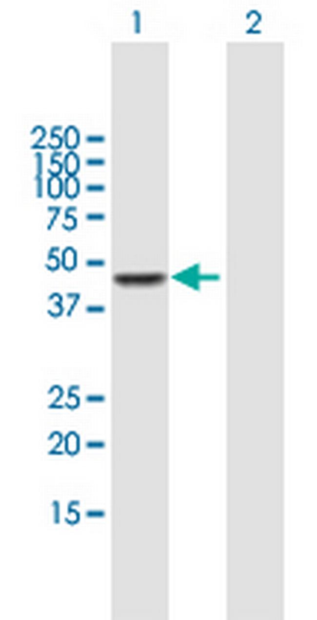CPA3 Antibody in Western Blot (WB)