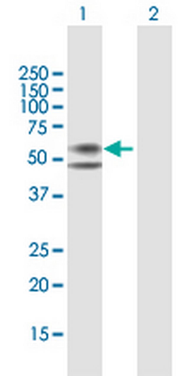 CPM Antibody in Western Blot (WB)