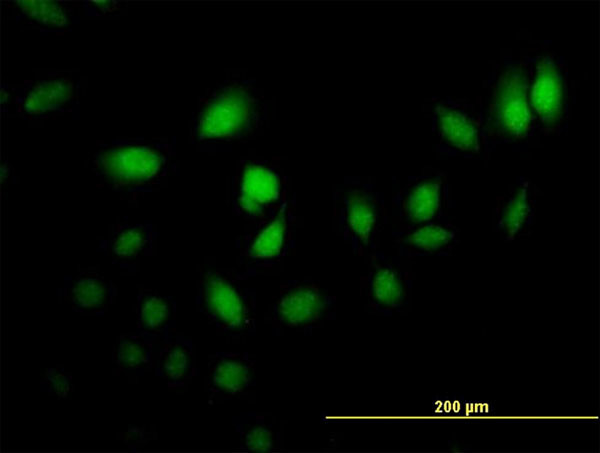 CRABP2 Antibody in Immunocytochemistry (ICC/IF)