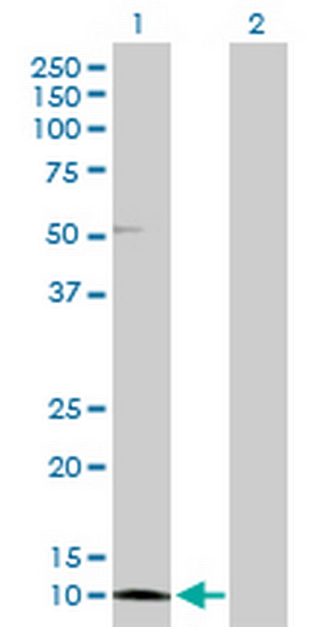 CRABP2 Antibody in Western Blot (WB)