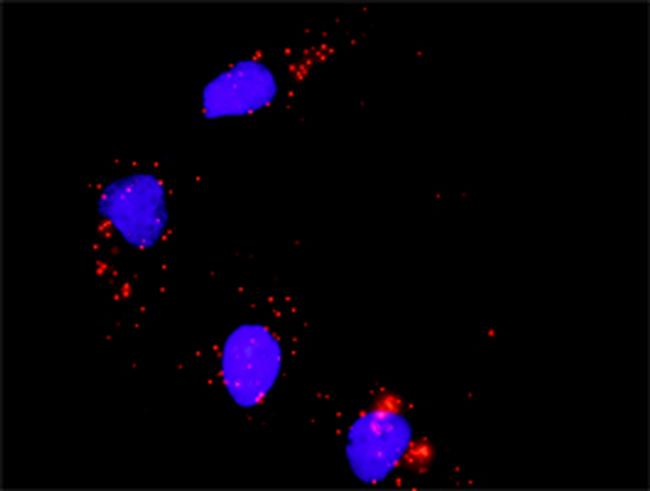 ATF2 Antibody in Proximity Ligation Assay (PLA) (PLA)