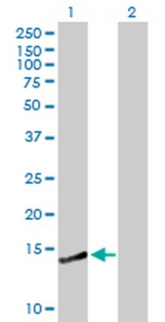 CREBL2 Antibody in Western Blot (WB)