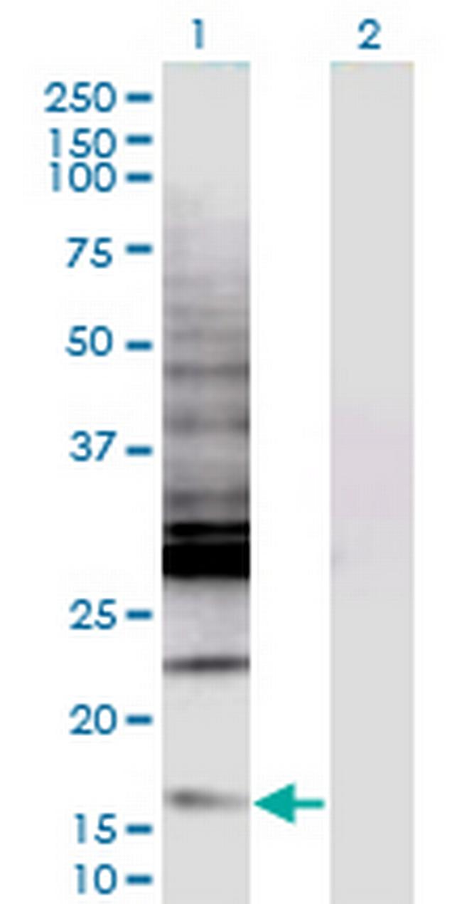 CREBL2 Antibody in Western Blot (WB)