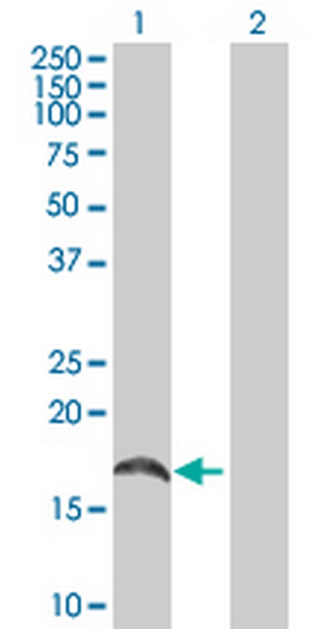 CREM Antibody in Western Blot (WB)
