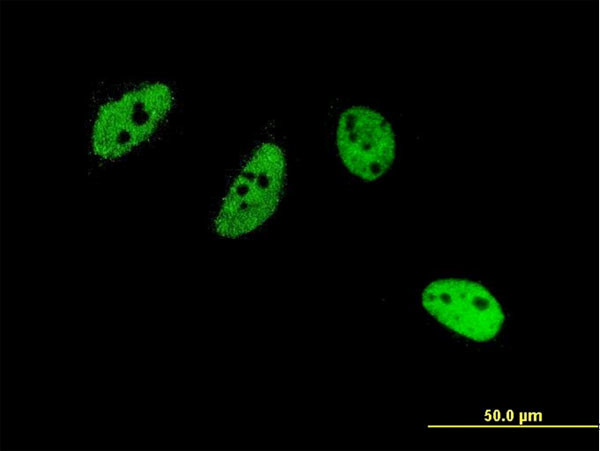 CREM Antibody in Immunocytochemistry (ICC/IF)