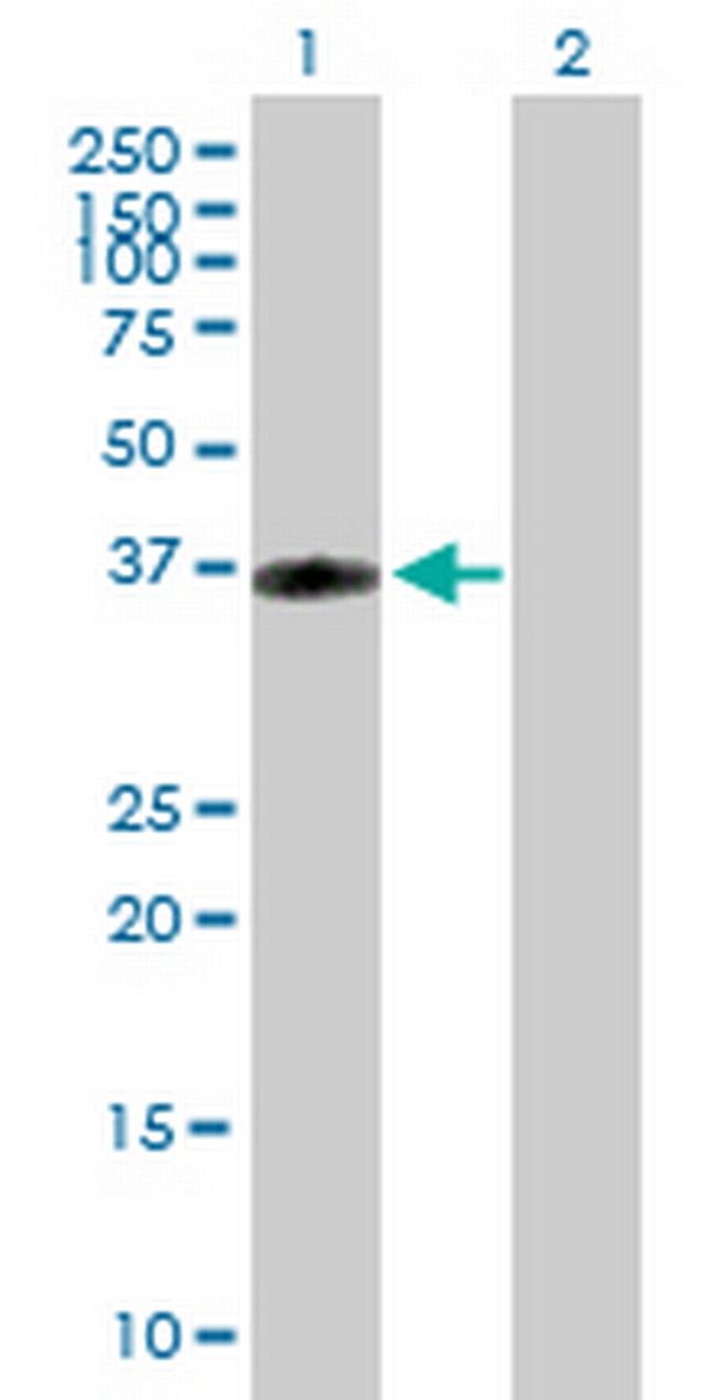 CRHR2 Antibody in Western Blot (WB)