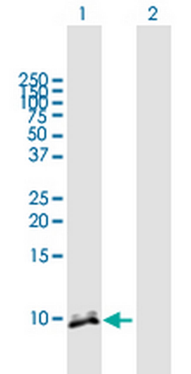 CRP Antibody in Western Blot (WB)