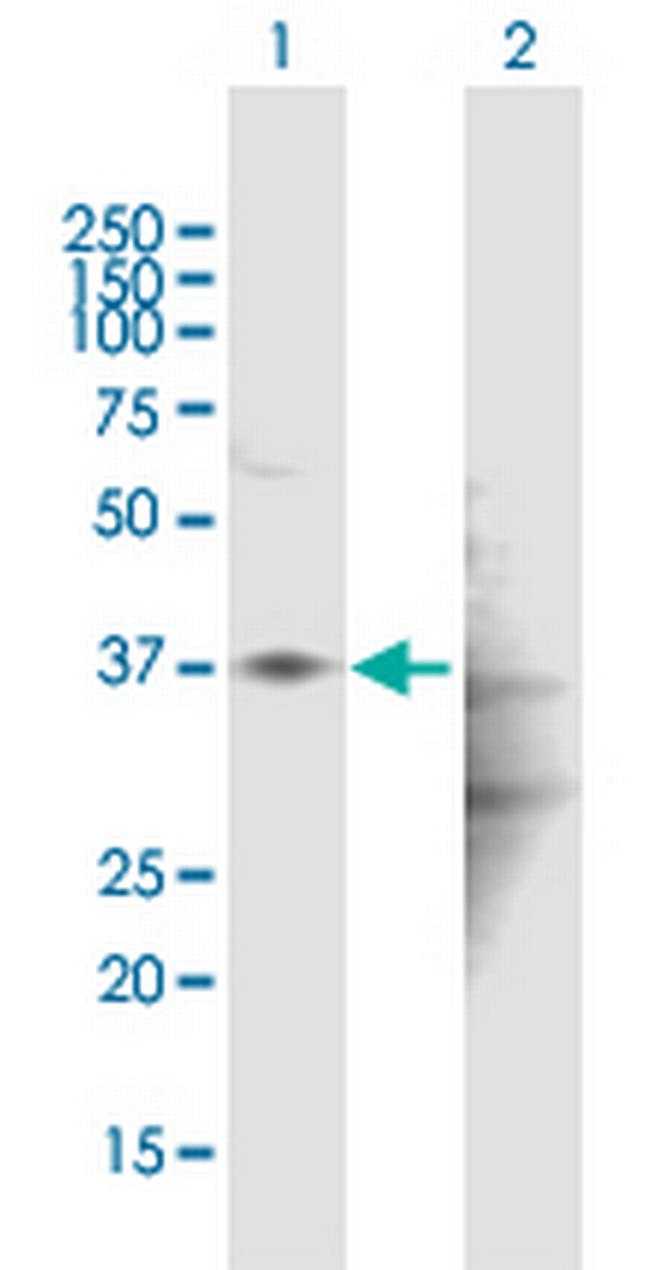 HAPLN1 Antibody in Western Blot (WB)
