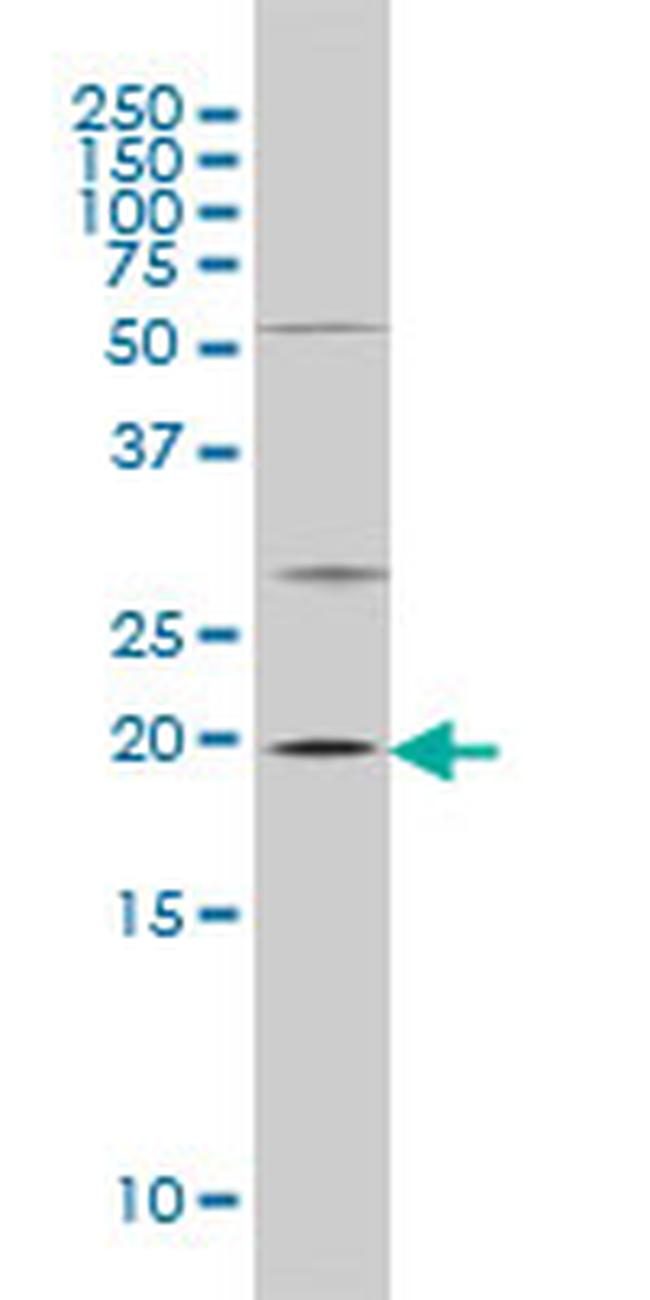 CRYAB Antibody in Western Blot (WB)