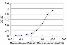 CRYAB Antibody in ELISA (ELISA)