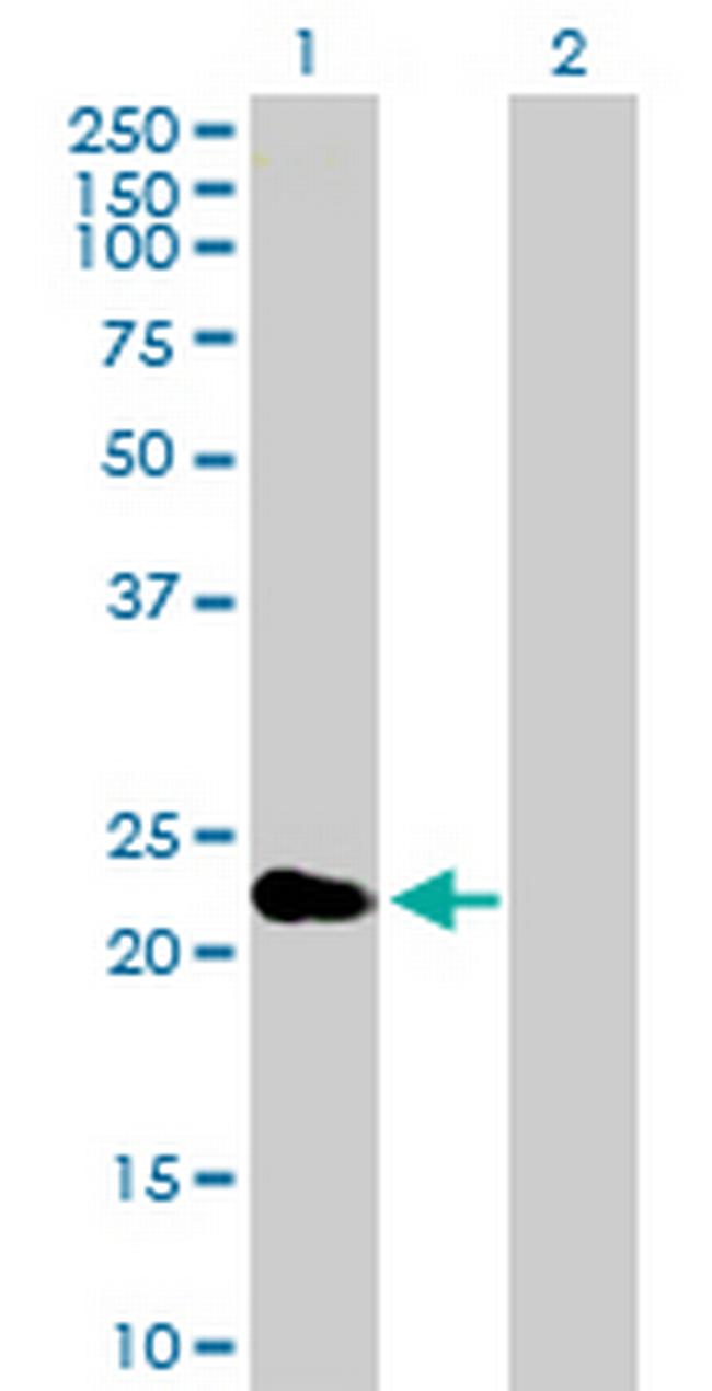 CRYBA2 Antibody in Western Blot (WB)