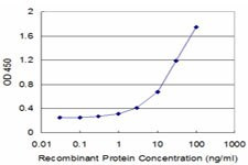 CRYBA2 Antibody in ELISA (ELISA)