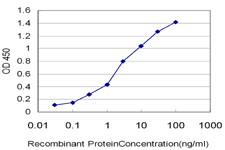 CRYBB1 Antibody in ELISA (ELISA)