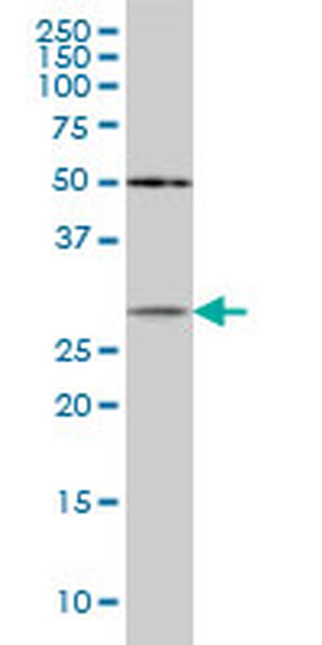 CRYBB1 Antibody in Western Blot (WB)