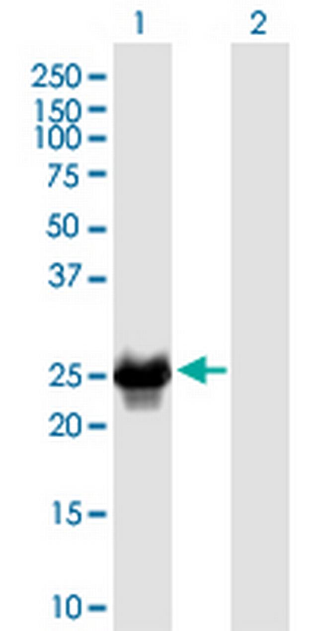 CRYBB2 Antibody in Western Blot (WB)