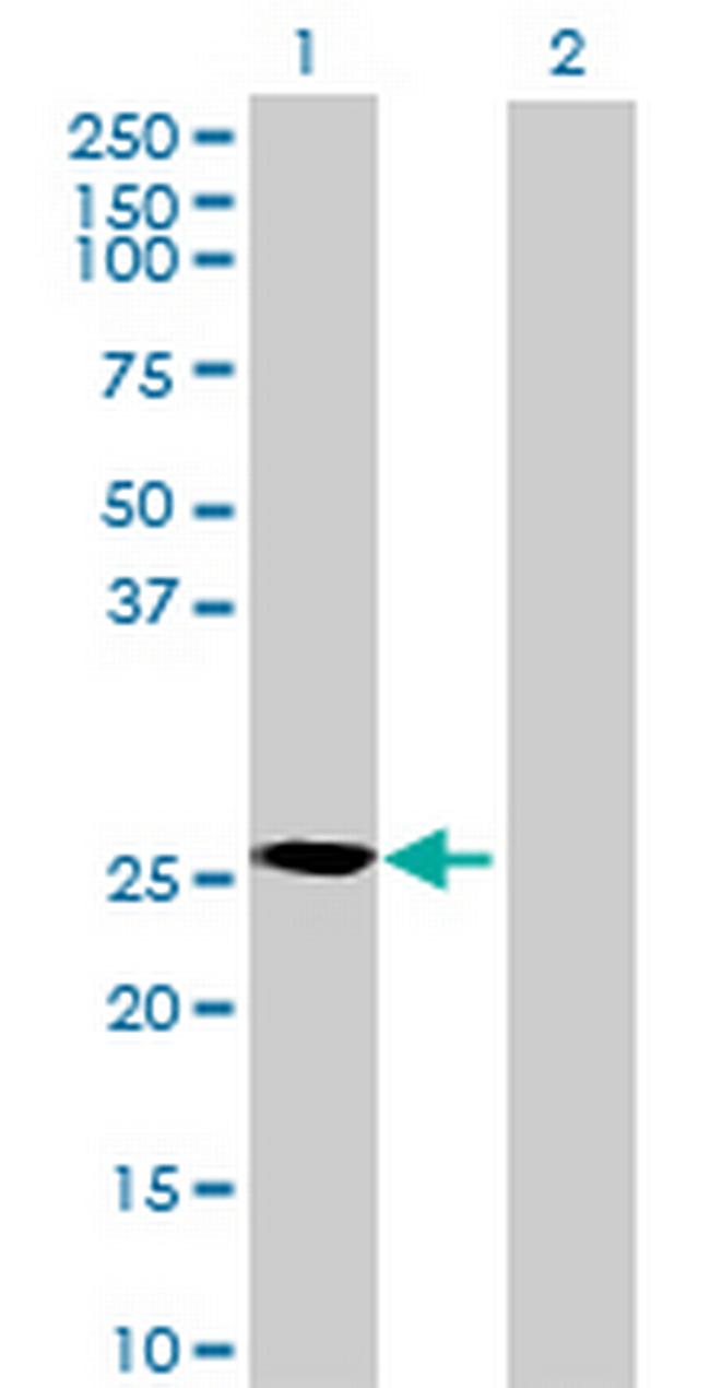 CRYBB3 Antibody in Western Blot (WB)