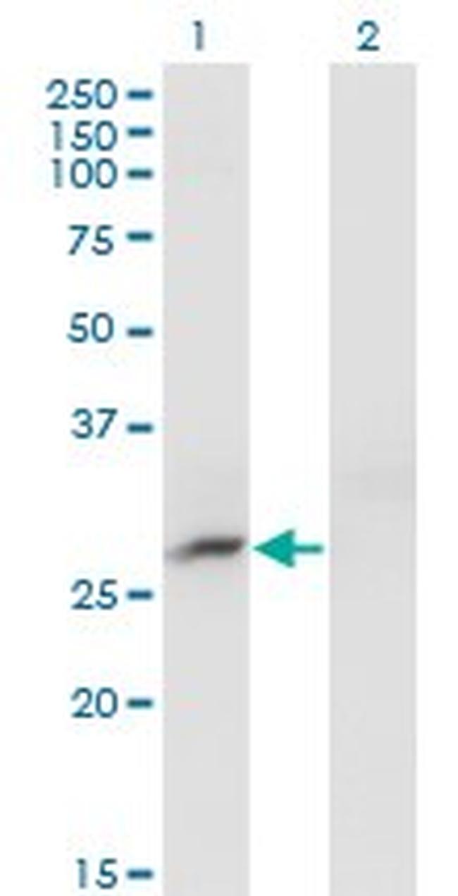 CRYBB3 Antibody in Western Blot (WB)