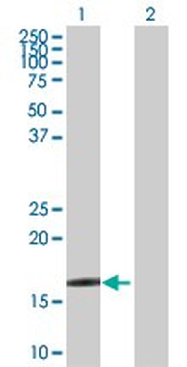CRYGD Antibody in Western Blot (WB)
