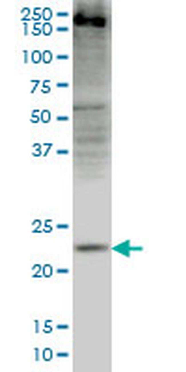 CRYGD Antibody in Western Blot (WB)