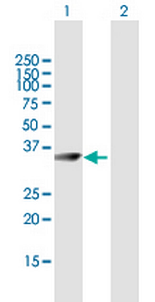 CRYM Antibody in Western Blot (WB)