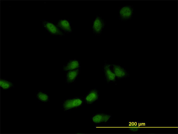 CSE1L Antibody in Immunocytochemistry (ICC/IF)