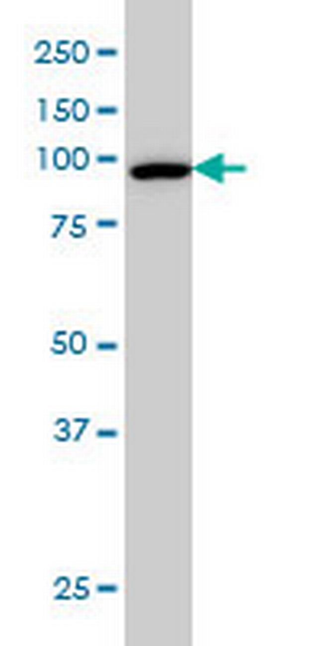CSE1L Antibody in Western Blot (WB)