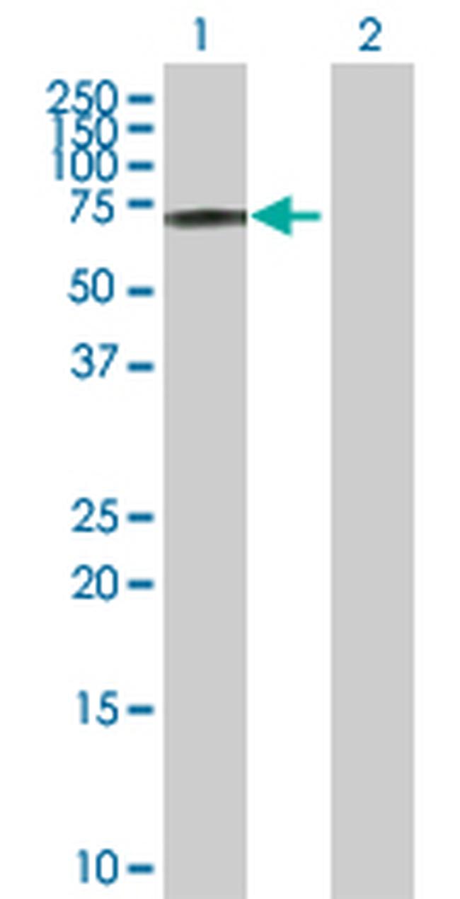CSF1 Antibody in Western Blot (WB)