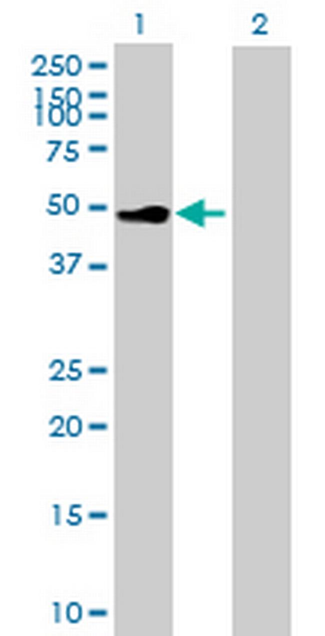CSF2RA Antibody in Western Blot (WB)