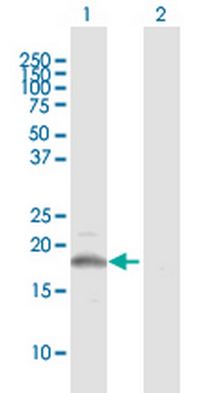 CSF3 Antibody in Western Blot (WB)