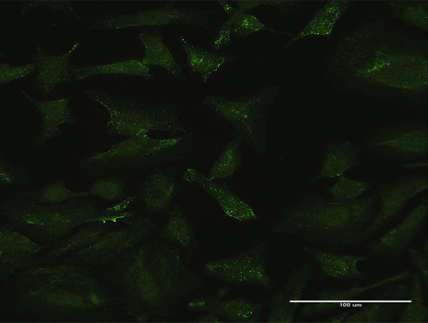CSF3 Antibody in Immunocytochemistry (ICC/IF)