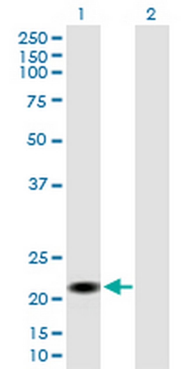 CSH2 Antibody in Western Blot (WB)