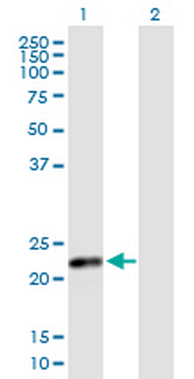 CSH2 Antibody in Western Blot (WB)