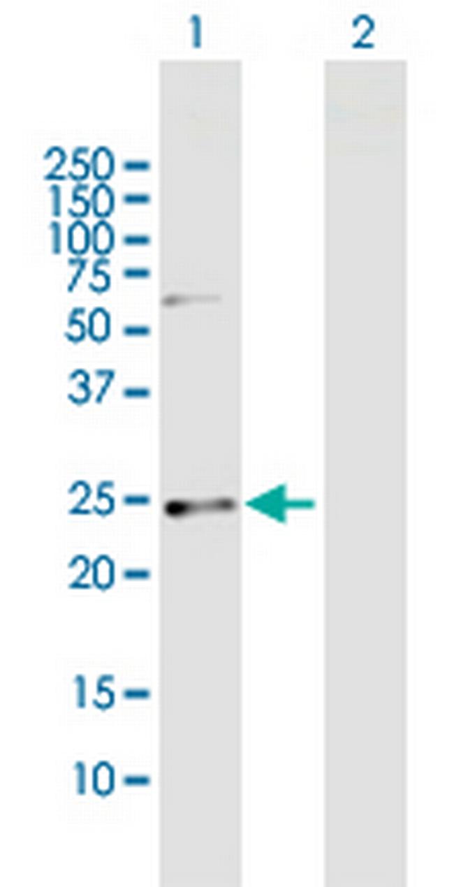 CSN1S1 Antibody in Western Blot (WB)