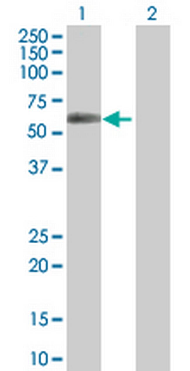 CSNK1G2 Antibody in Western Blot (WB)
