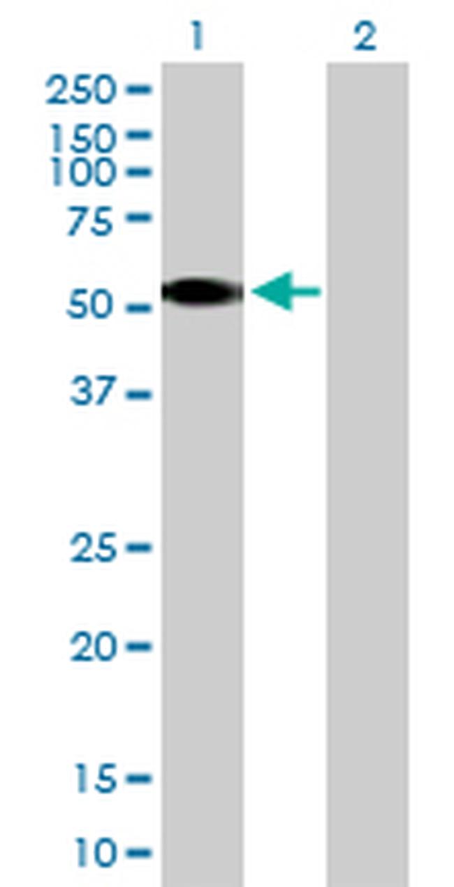 CSNK1G2 Antibody in Western Blot (WB)