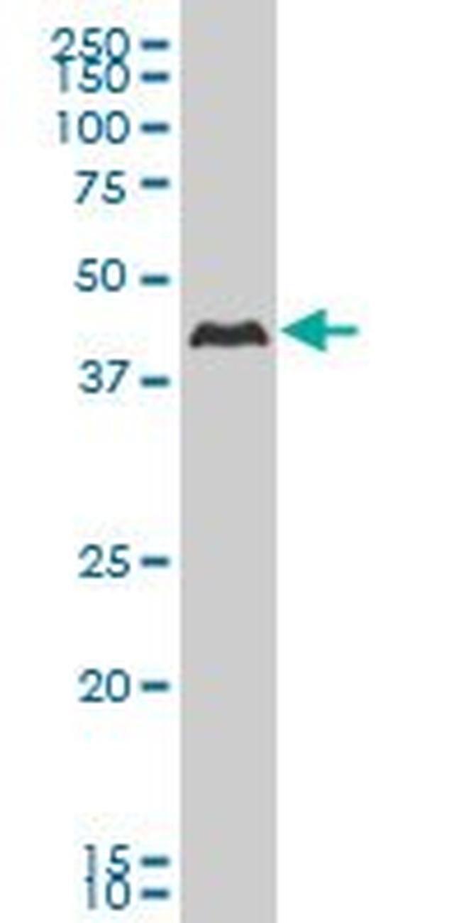 CSNK1G2 Antibody in Western Blot (WB)