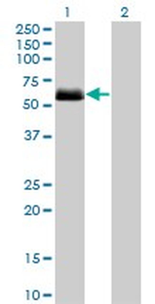 CSNK1G2 Antibody in Western Blot (WB)
