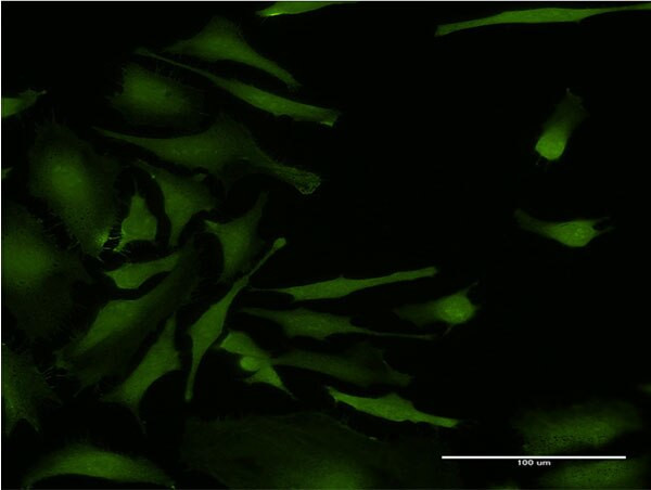 CSNK2A2 Antibody in Immunocytochemistry (ICC/IF)