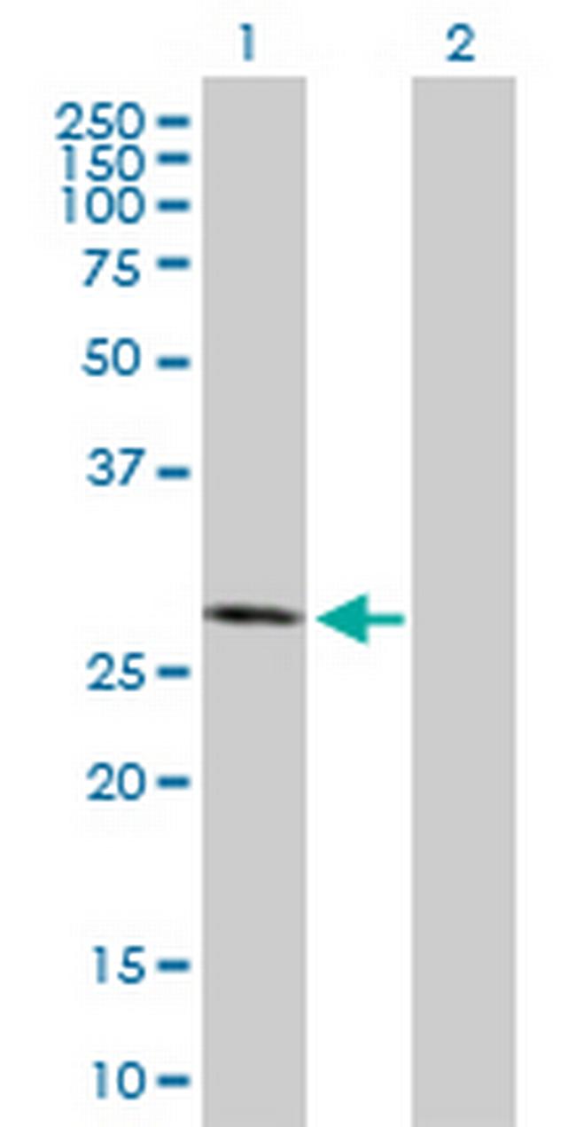 CSNK2B Antibody in Western Blot (WB)