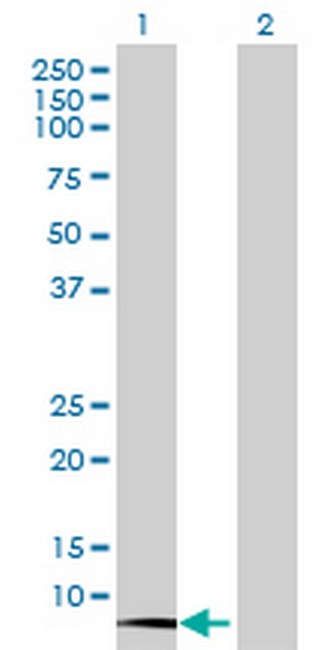 CST3 Antibody in Western Blot (WB)