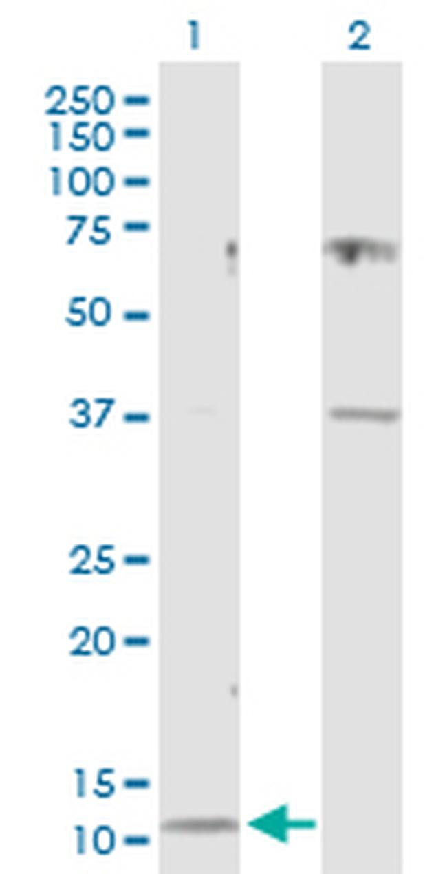 CST3 Antibody in Western Blot (WB)