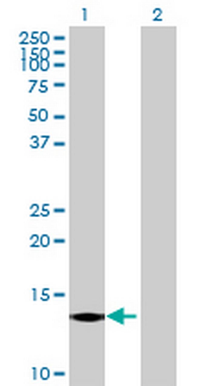 CST6 Antibody in Western Blot (WB)
