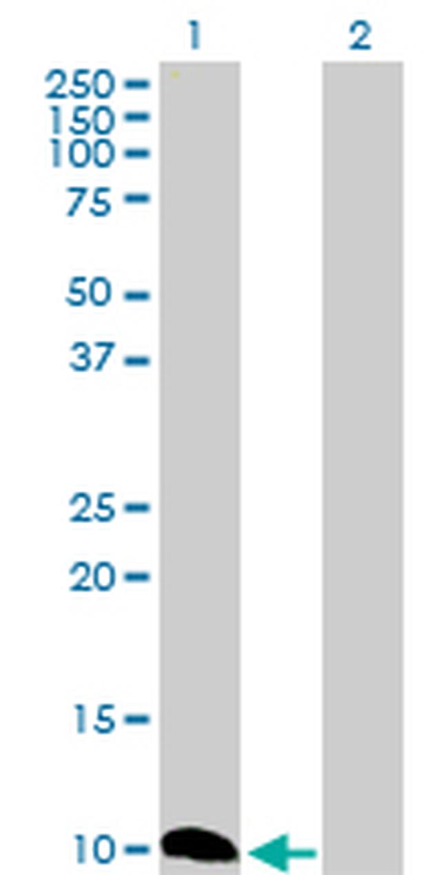 CSTB Antibody in Western Blot (WB)