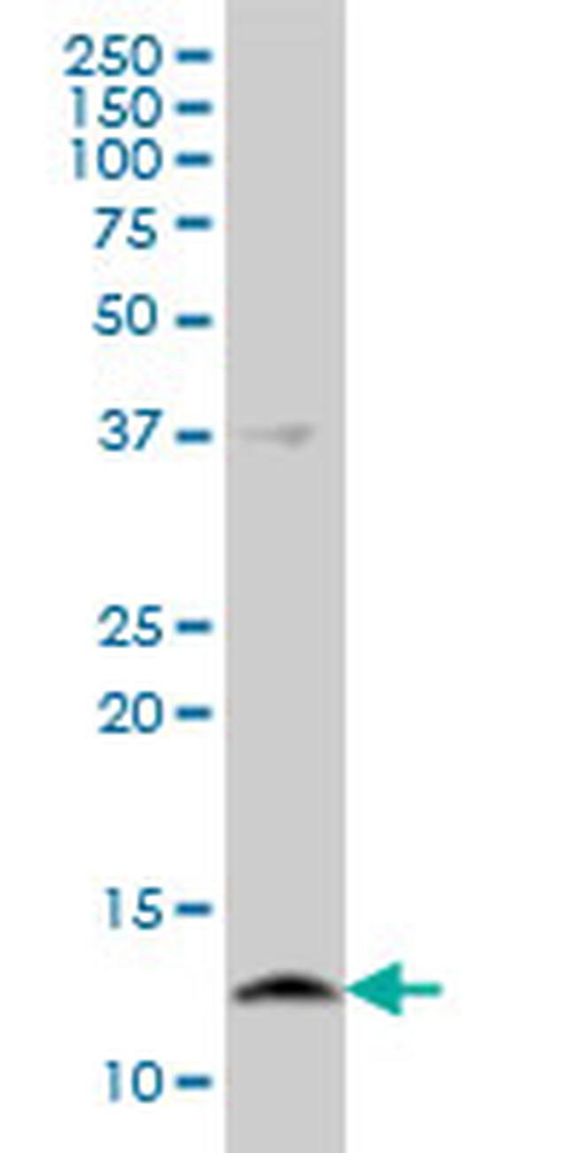 CSTB Antibody in Western Blot (WB)